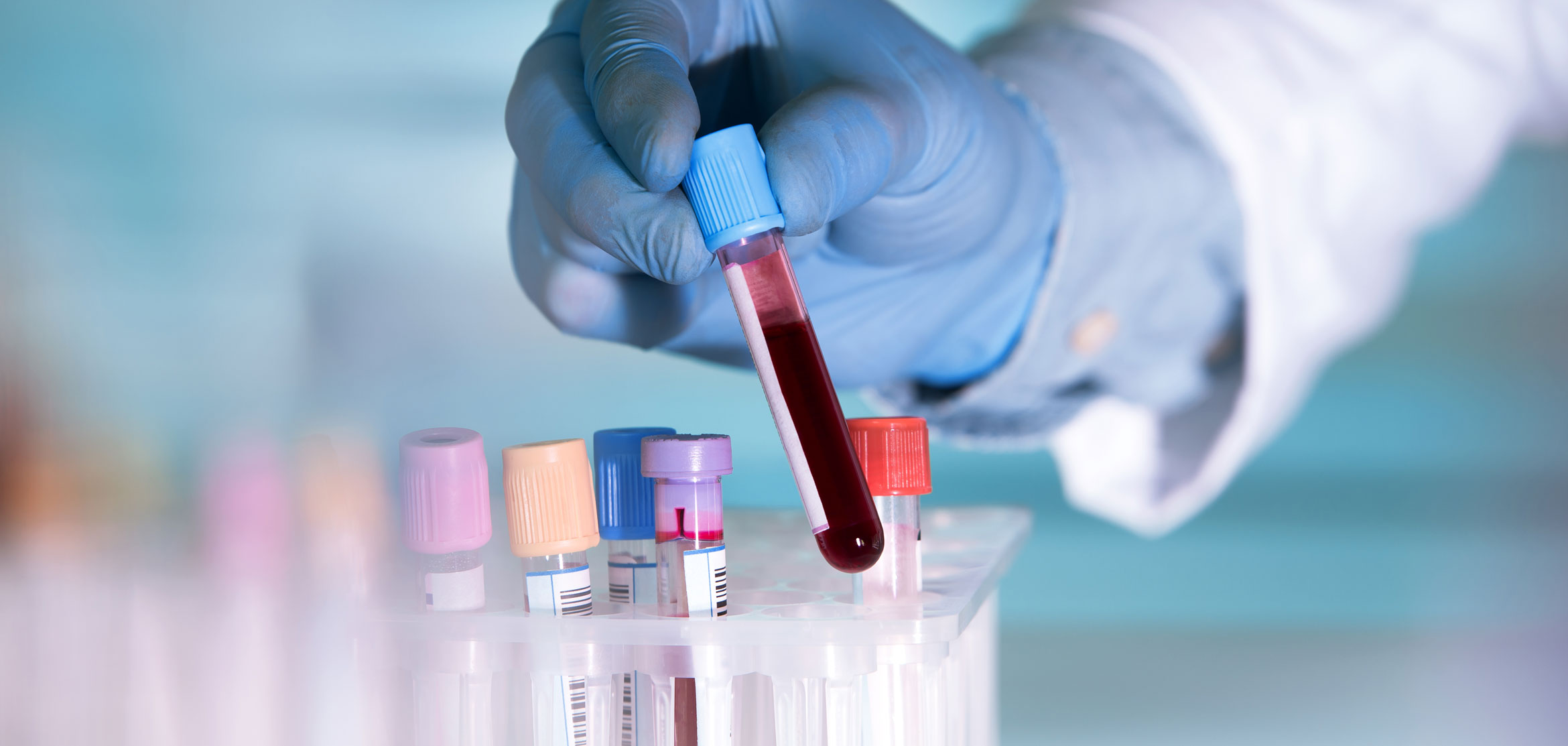 Blutspenden im Sonnen-Gesundheitszentrum in München